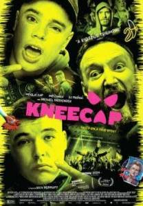 Коленная чашечка / Kneecap Коленная чашечка / Kneecap