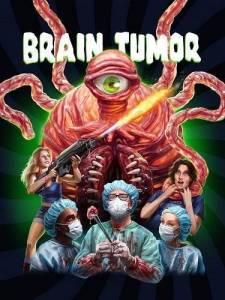 ������� ����� / Brain Tumor
